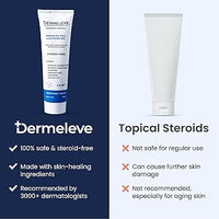 Crema antipicazón sin esteroides, extra fuerte para psoriasis, dermatitis seborreica, erupción viral, picaduras de insectos, alergia, urticaria crónica, neuropatía - La Tiendita de la Jose