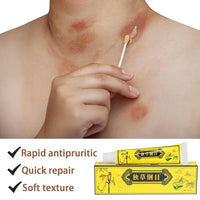 5 unids chino herbario crema dermatitis y eccema prurito psoriasis ungüento
