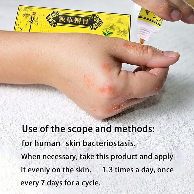 5 unids chino herbario crema dermatitis y eccema prurito psoriasis ungüento
