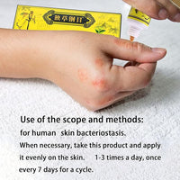 5 unids chino herbario crema dermatitis y eccema prurito psoriasis ungüento