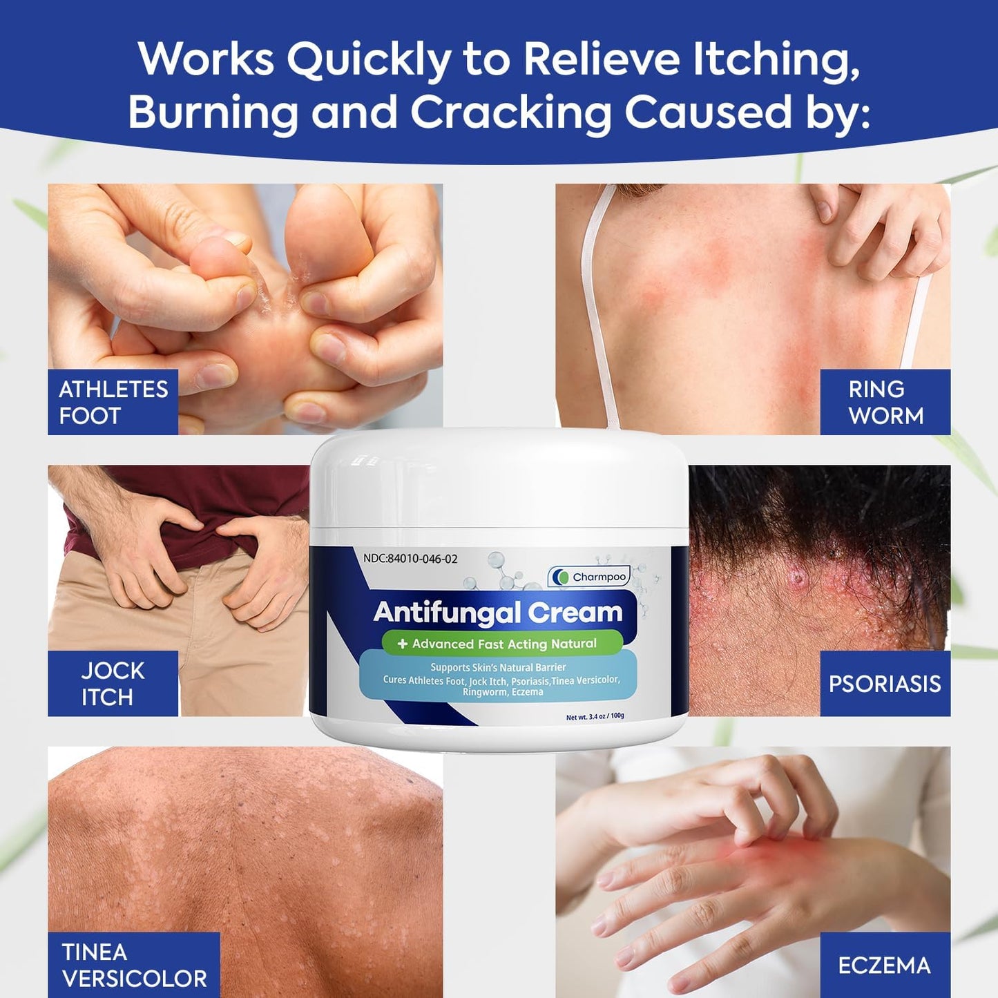 Crema antifúngica para la picazón Charmpoo - La Tiendita de la Jose