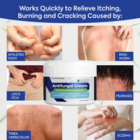 Crema antifúngica para la picazón Charmpoo - La Tiendita de la Jose