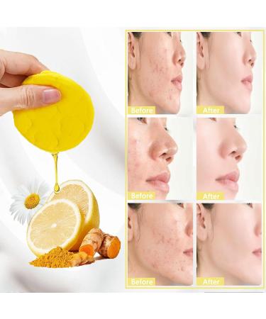 Almohadillas limpiadoras de cúrcuma y ácido kójico (50 unidades) - La Tiendita de la Jose