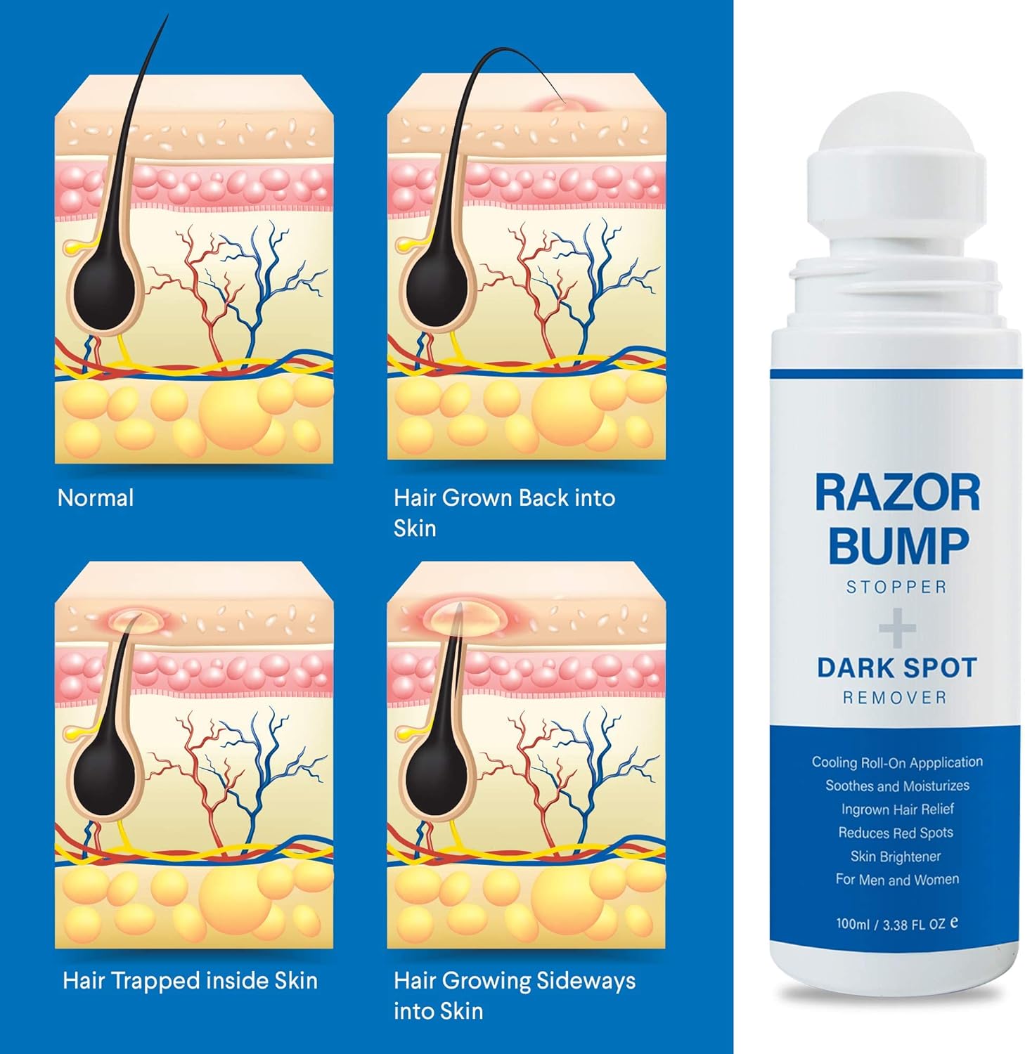 Removedor de Puntos Negros Sielkin - La Tiendita de la Jose