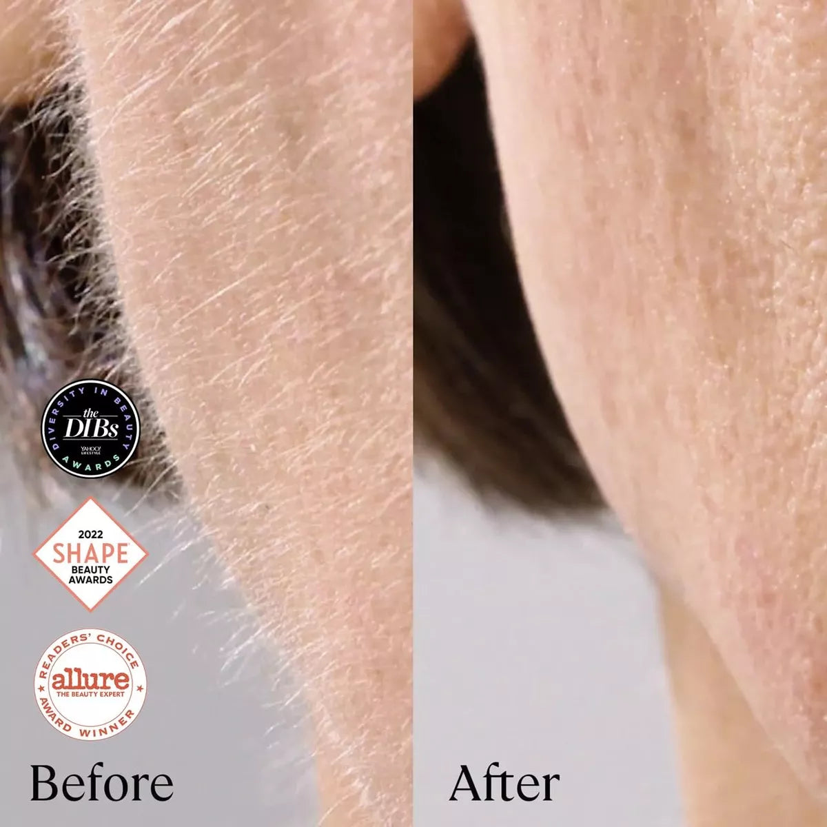 Sistema De Dermaplanamiento Michael Todd Beauty Sonicsmooth - La Tiendita de la Jose