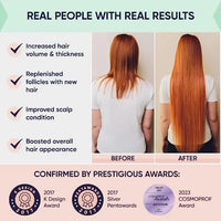 Aclarador Para El Cabello Moerie Ultimate Hair Growth Spray