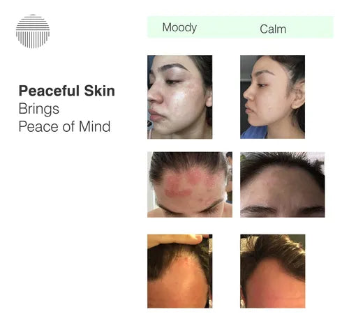 Serum Dermazen Calming Seborreic Para Cabello, Rostro Y Cuerpo - La Tiendita de la Jose